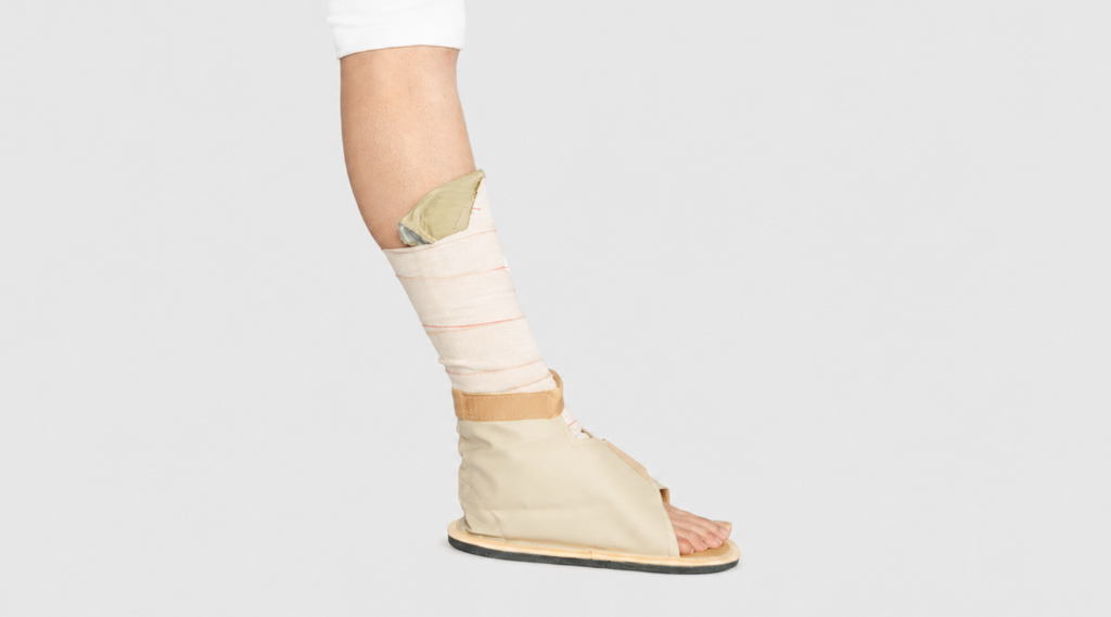Cast Shoes